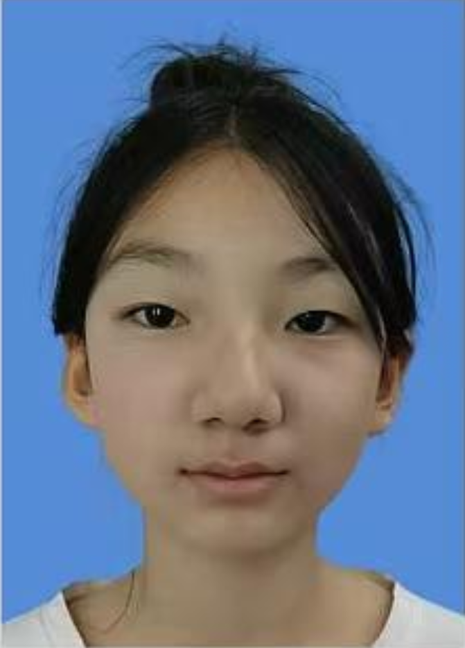 李昕